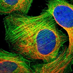 Myosin Phosphatase 2 Antibody, Novus Biologicals 0.1mL; Unlabeled:Antibodies,